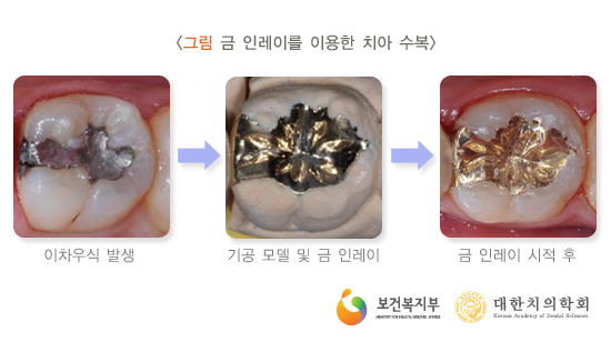 옥련서울치과 이미지