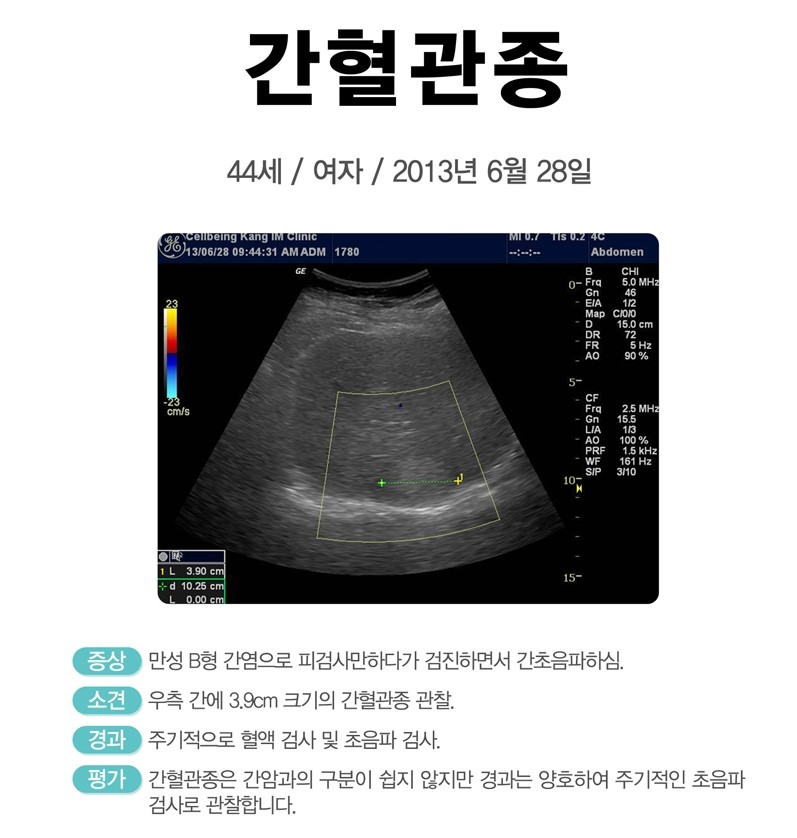 셀빙강내과의원 이미지
