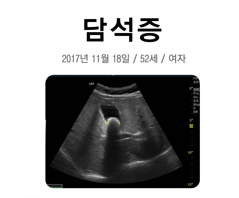 셀빙강내과의원 이미지
