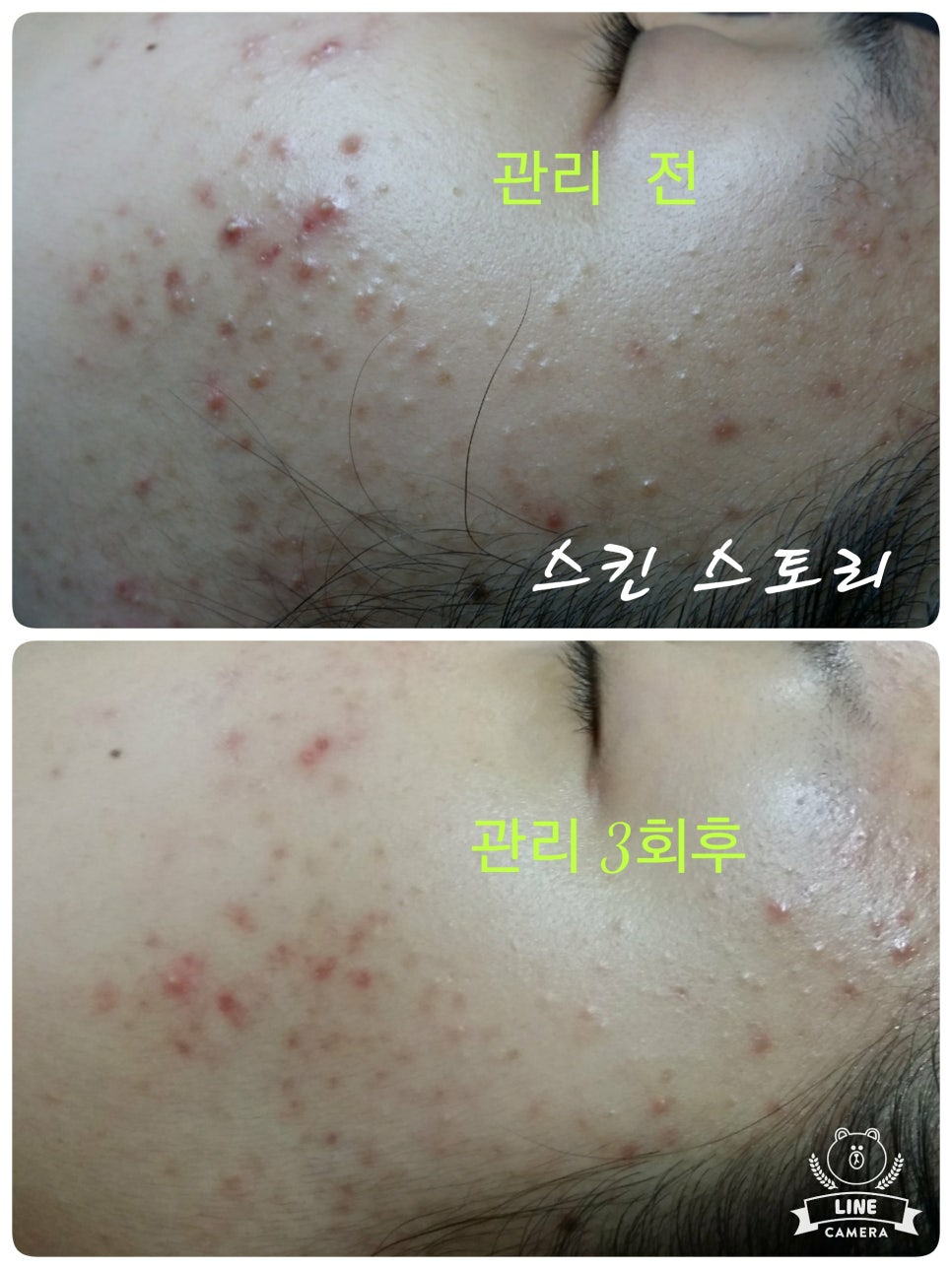 스킨스토리 이미지