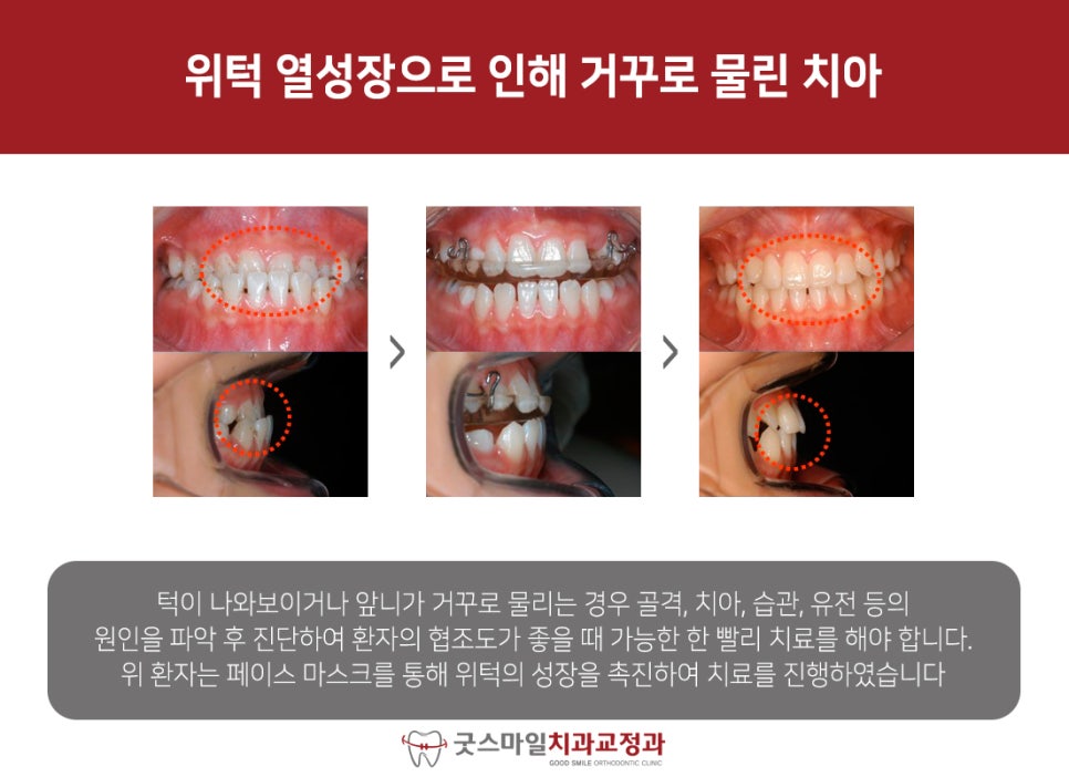 굿페이스의원 이미지