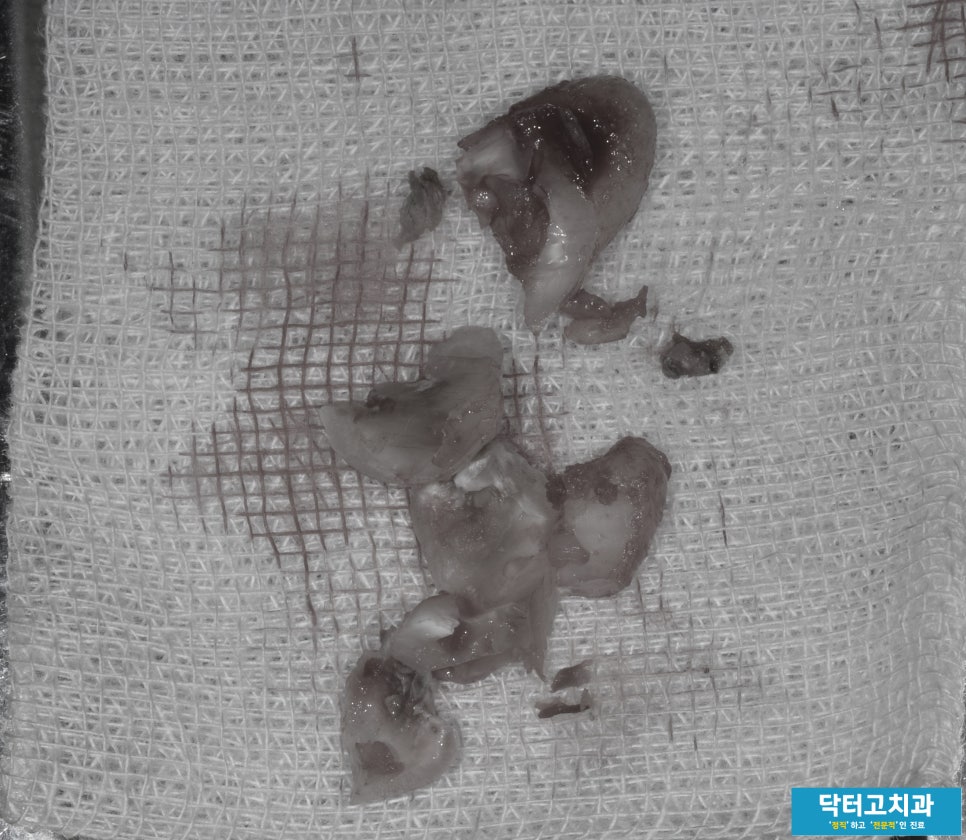 고치과 이미지