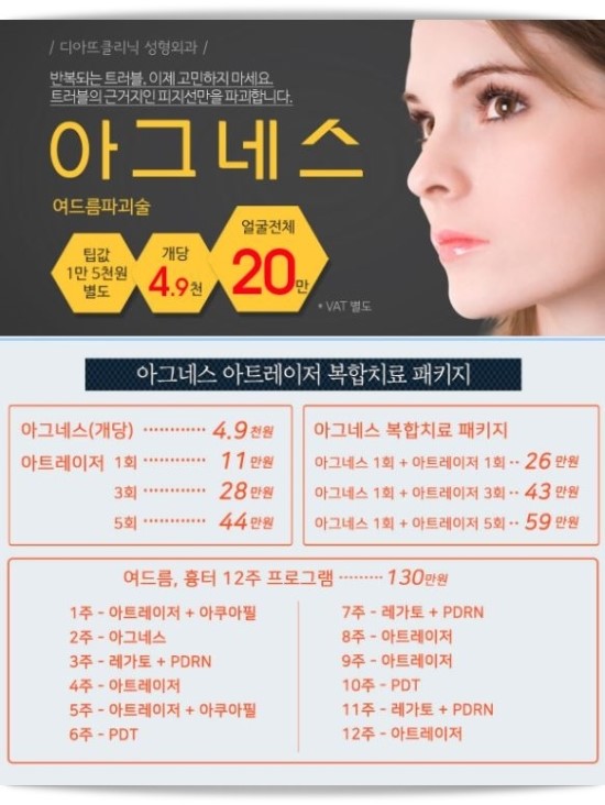 아그네스 이미지