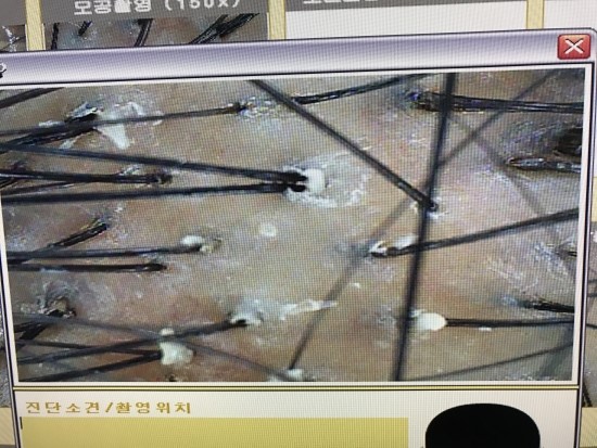 비타브리드스칼프케어 이미지