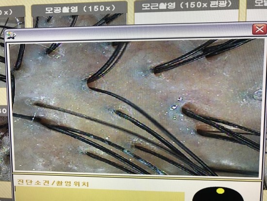 비타브리드스칼프케어 이미지