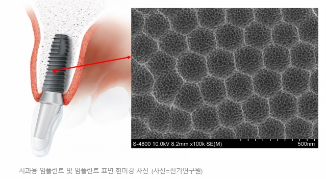 한국표면처리(주) 이미지