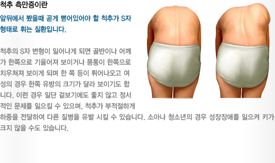 바디체인지체형교정 이미지