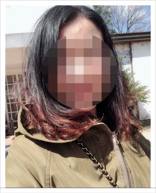 미가헤어라인 이미지
