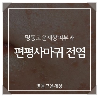 명동고운세상피부과의원 이미지
