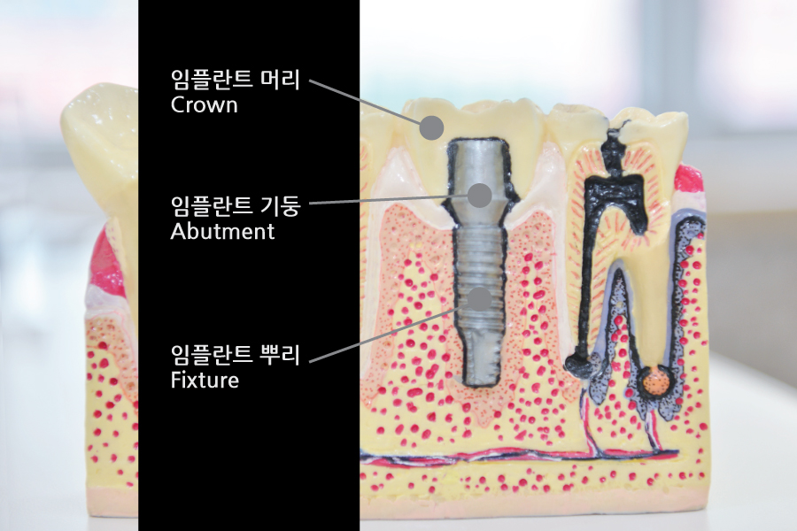 이-프란트치과 이미지