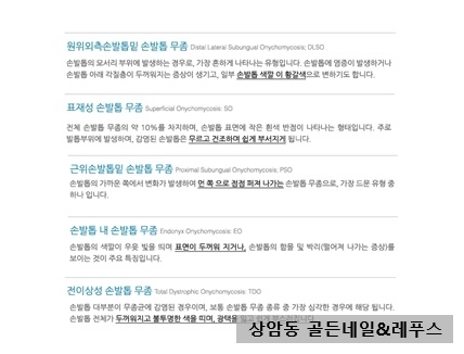 골든네일&레푸스 이미지