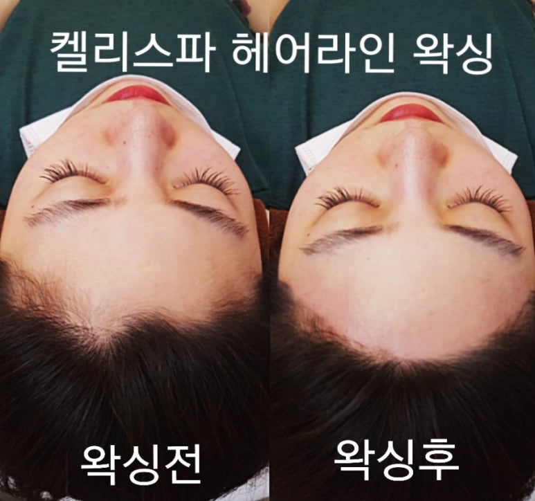 켈리스파 이미지