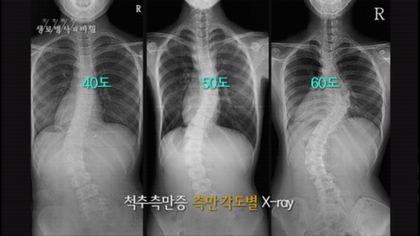 RBT체형교정운동센터 이미지