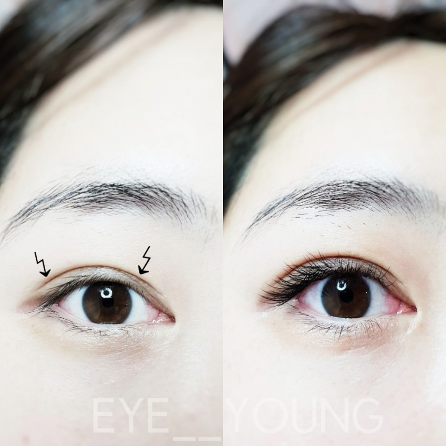 EYE이뻐 이미지