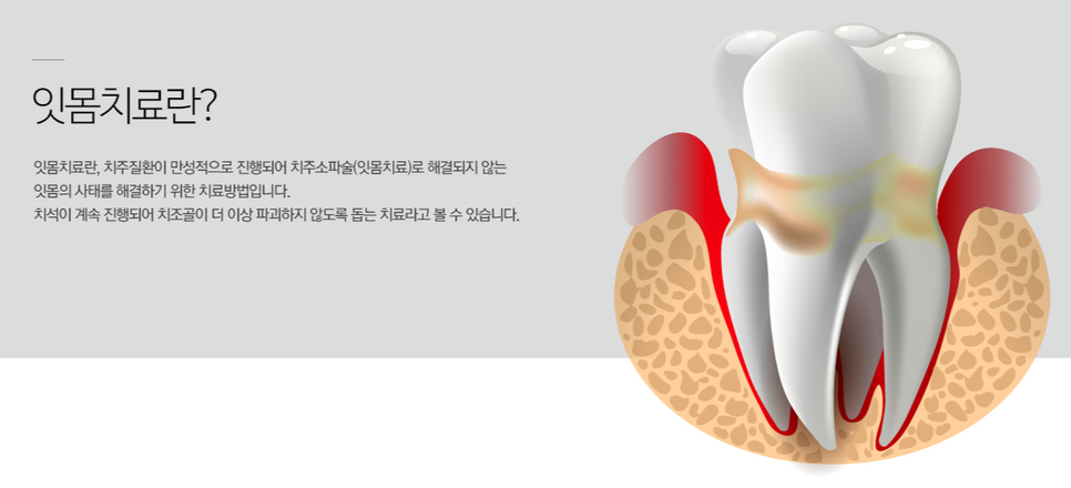 아름다운차이치과 이미지