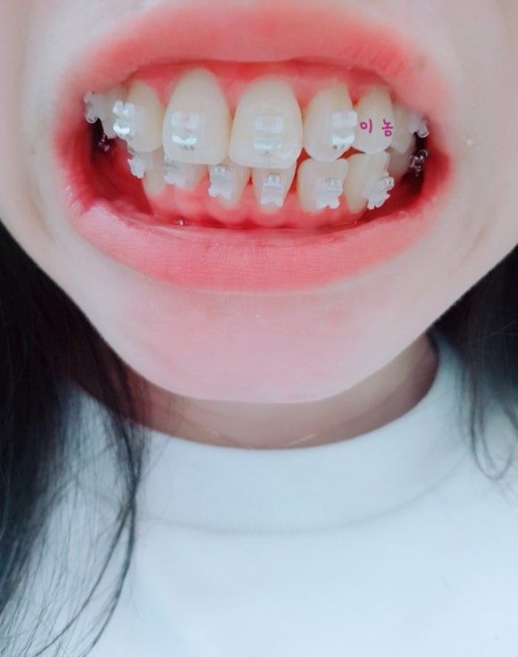 불당치과교정과치과의원 이미지