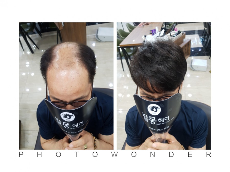 김호증모가발부산서구번헤어 이미지