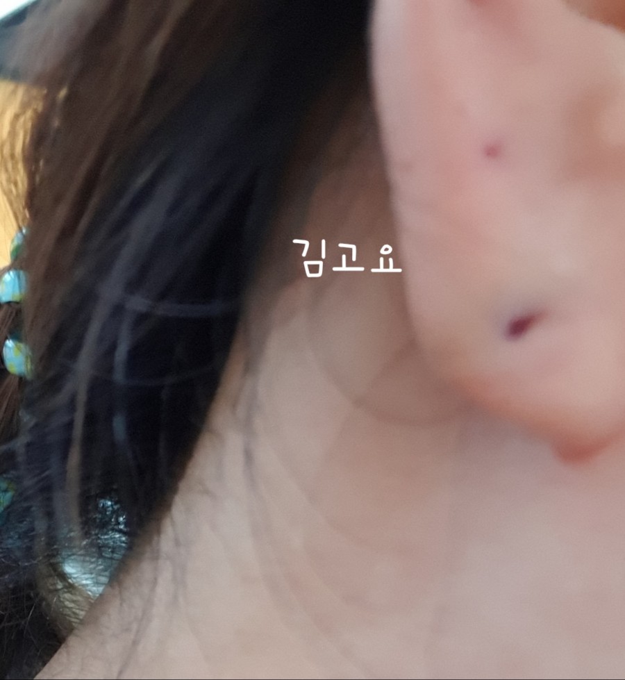 양군피어싱 이미지