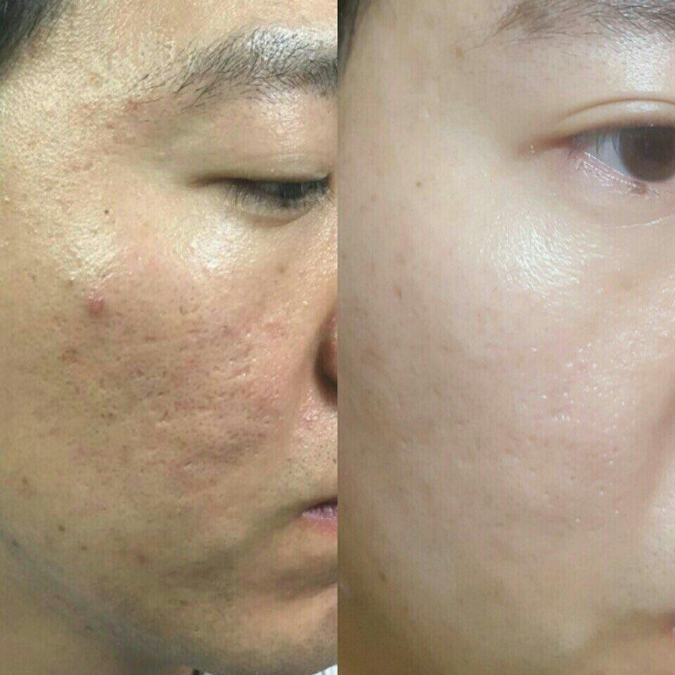 더이쁜피부 이미지