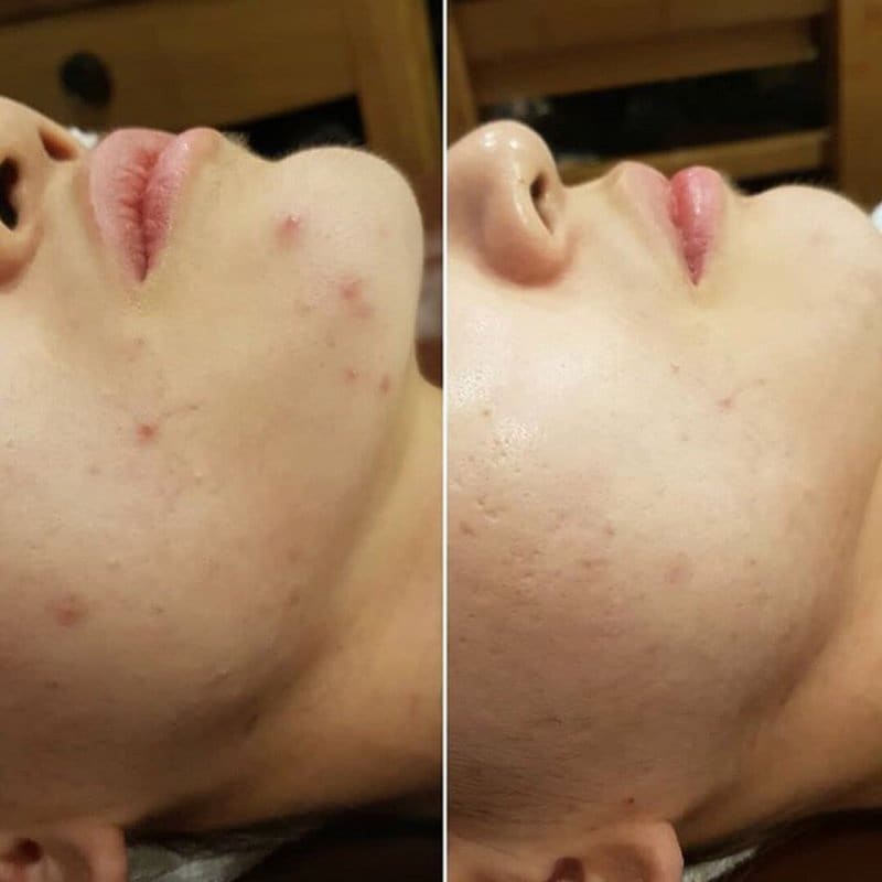 더이쁜피부 이미지