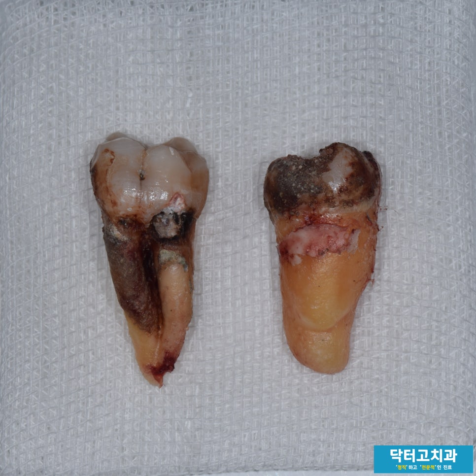 고치과 이미지