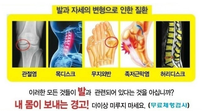 알즈너대한 이미지