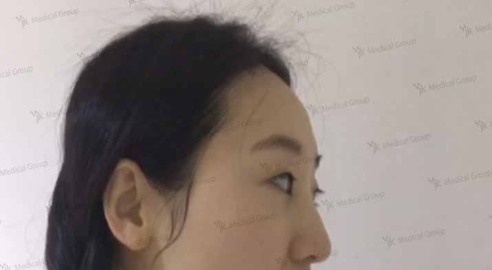 ภาพก่อนผ่าตัด