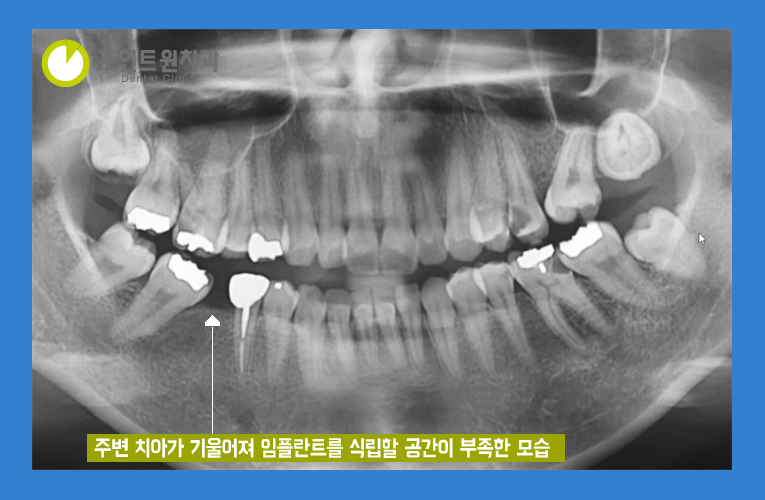 포인트원치과의원 이미지