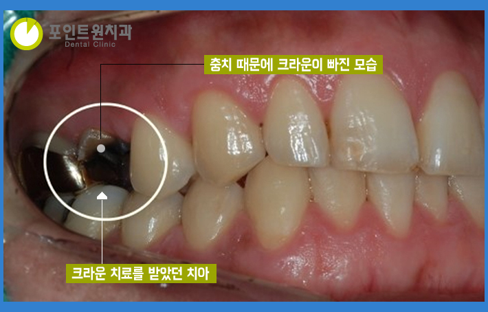 포인트원치과의원 이미지