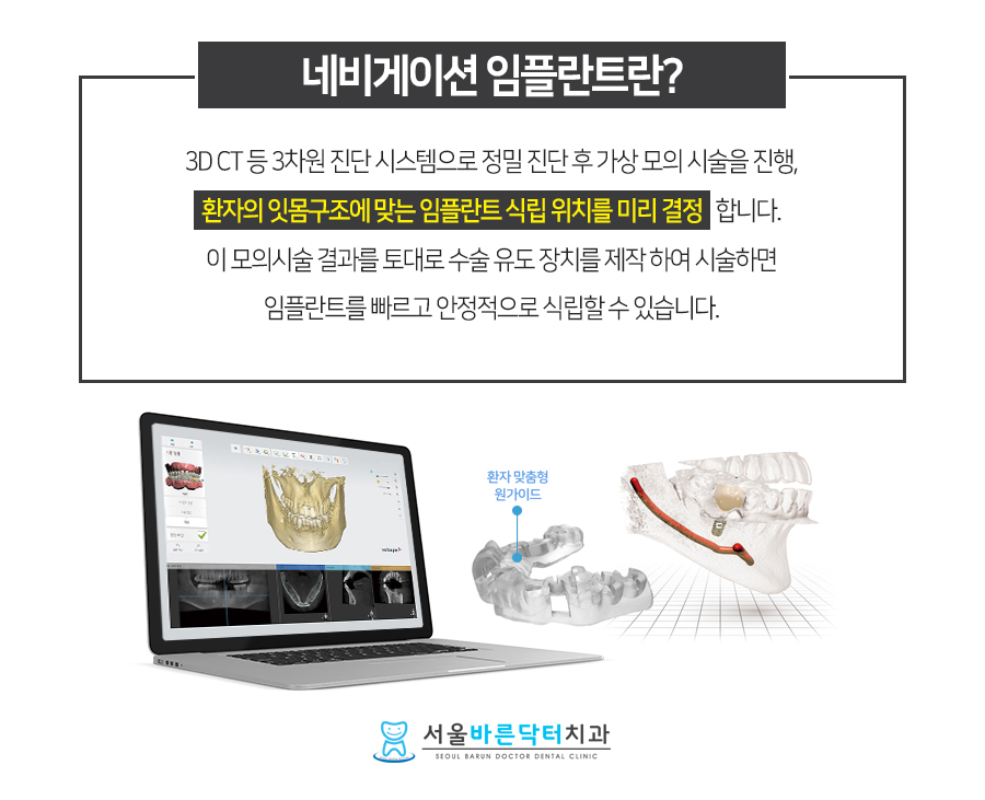 바른본치과 이미지