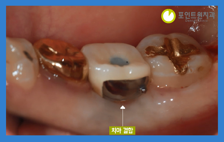 포인트원치과의원 이미지