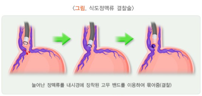 지금건강 이미지