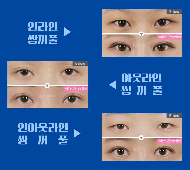 미호의원 이미지