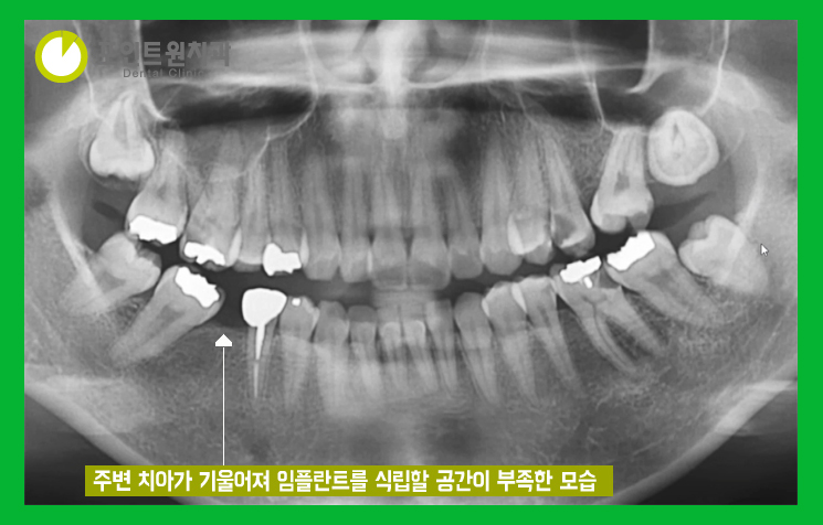 포인트원치과의원 이미지