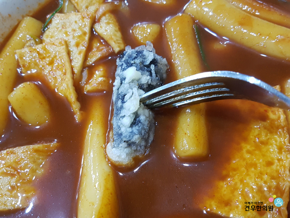 고릴라떡볶이 이미지