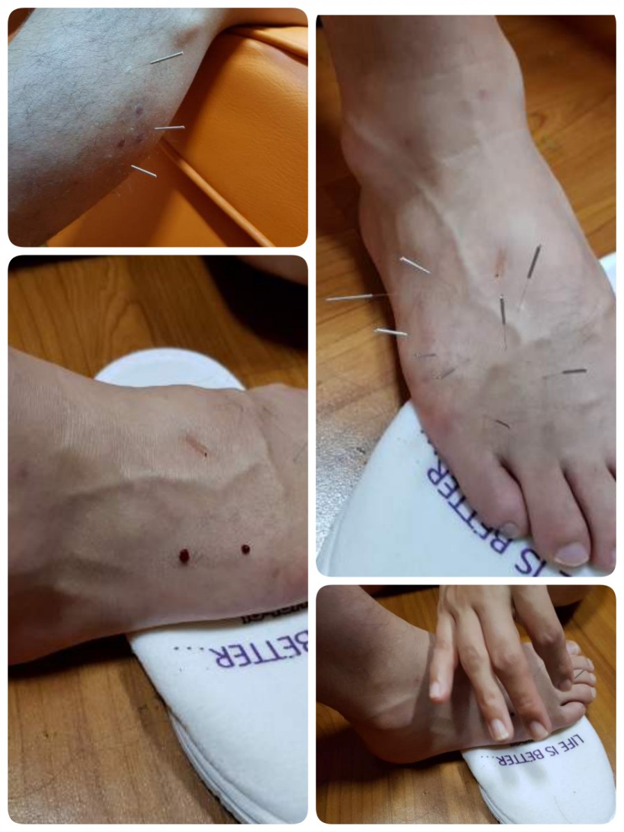 왼발오른발 이미지