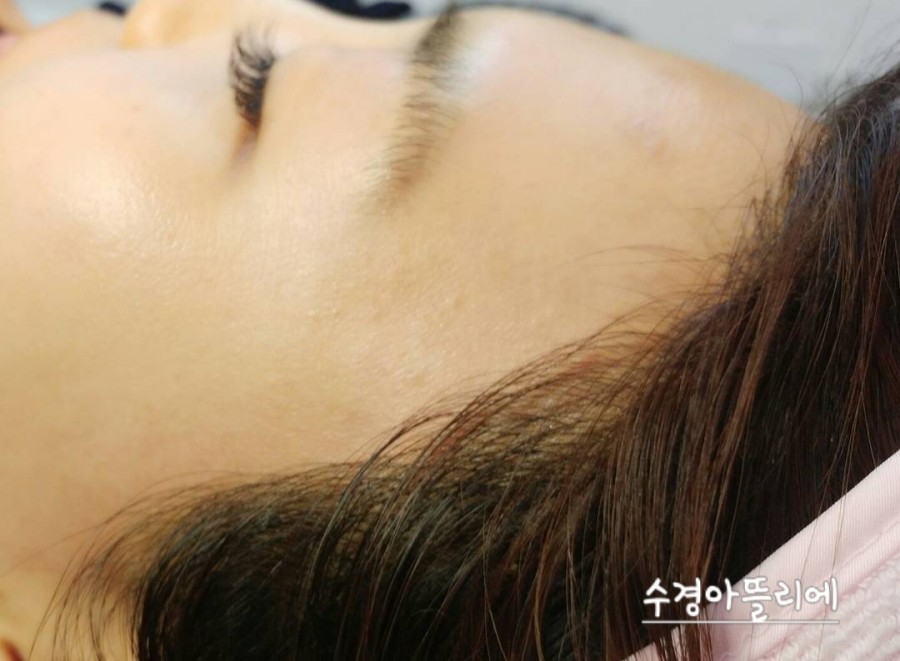 수경헤어라인 이미지
