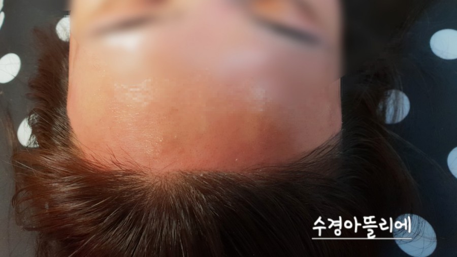 수경헤어라인 이미지