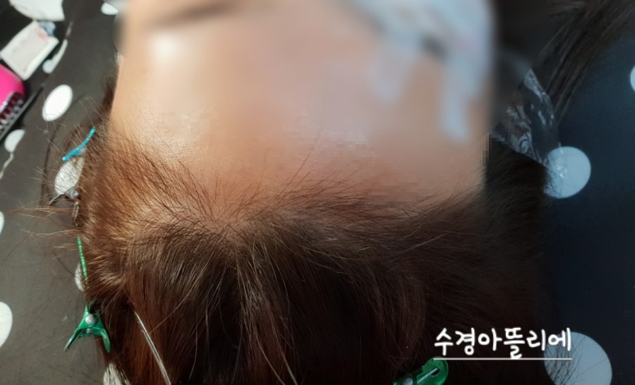 수경헤어라인 이미지