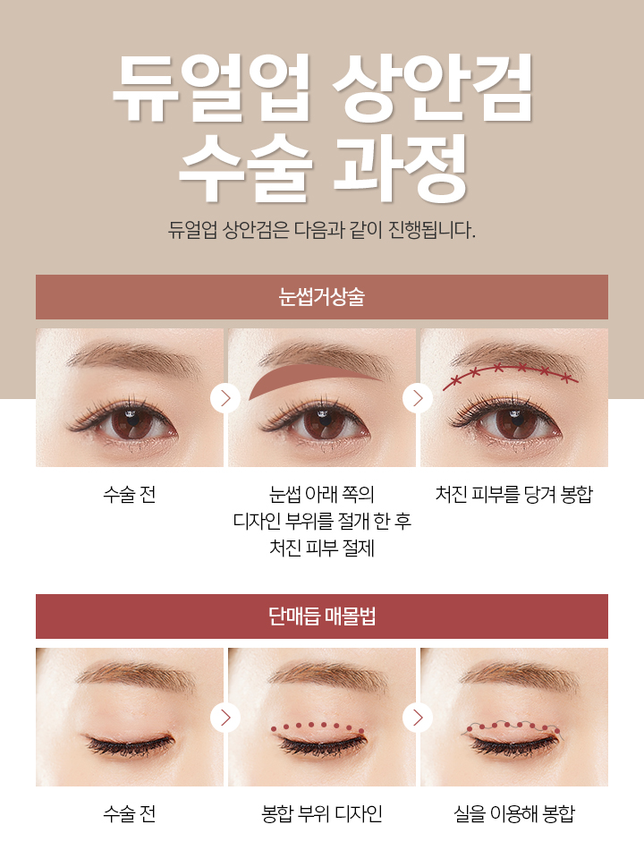 미본 이미지