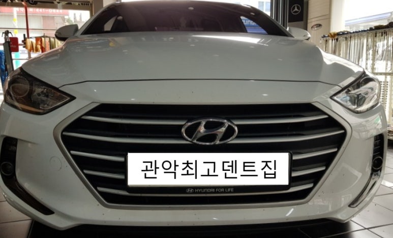 관악최고덴트집 이미지