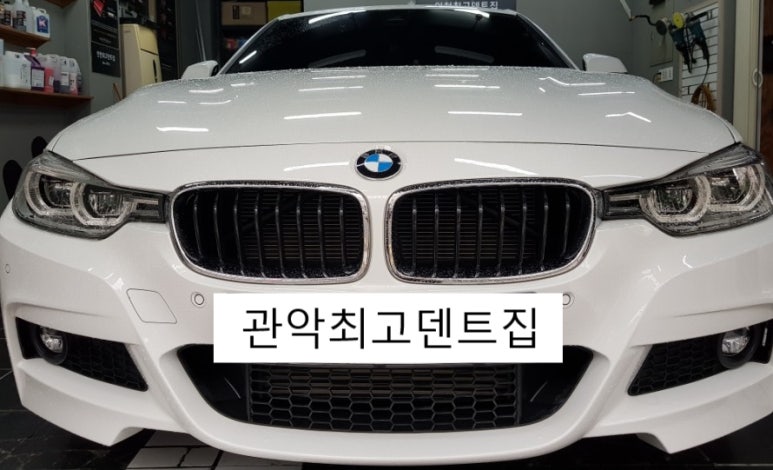 관악최고덴트집 이미지