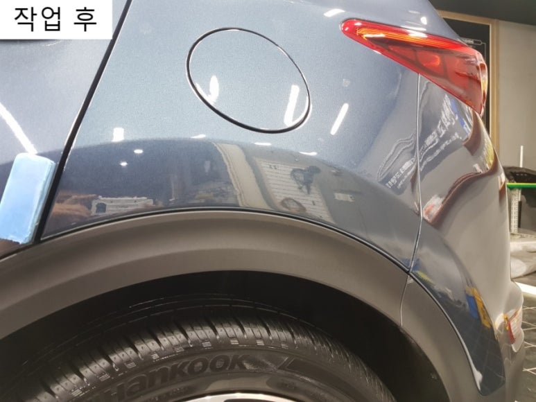 관악최고덴트집 이미지