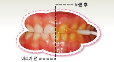 미소진치과의원 이미지