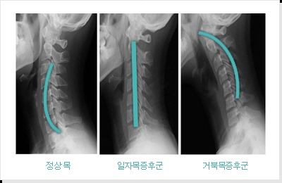 (유)목인 이미지