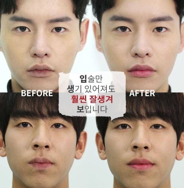 낫포유 이미지
