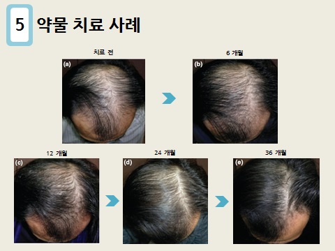 미지예피부과의원 이미지