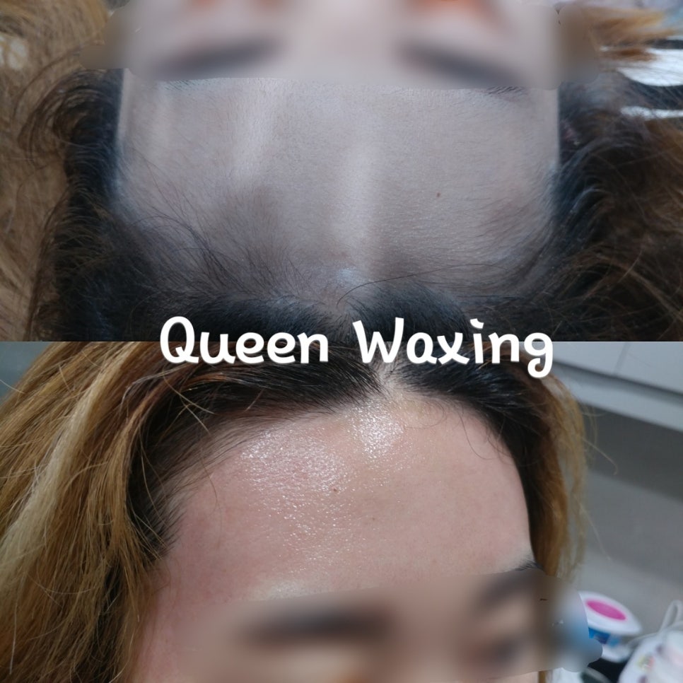 퀸헤어라인 이미지