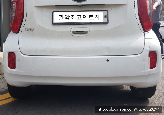 관악최고덴트집 이미지