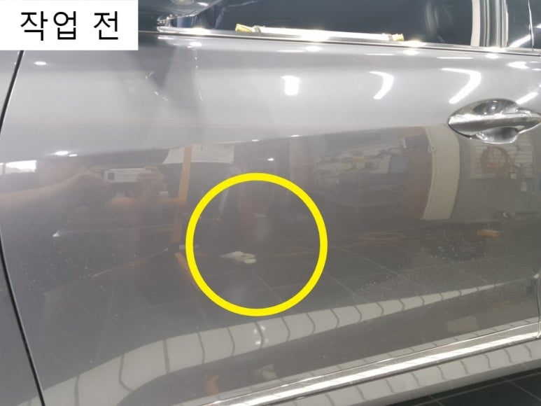 관악최고덴트집 이미지